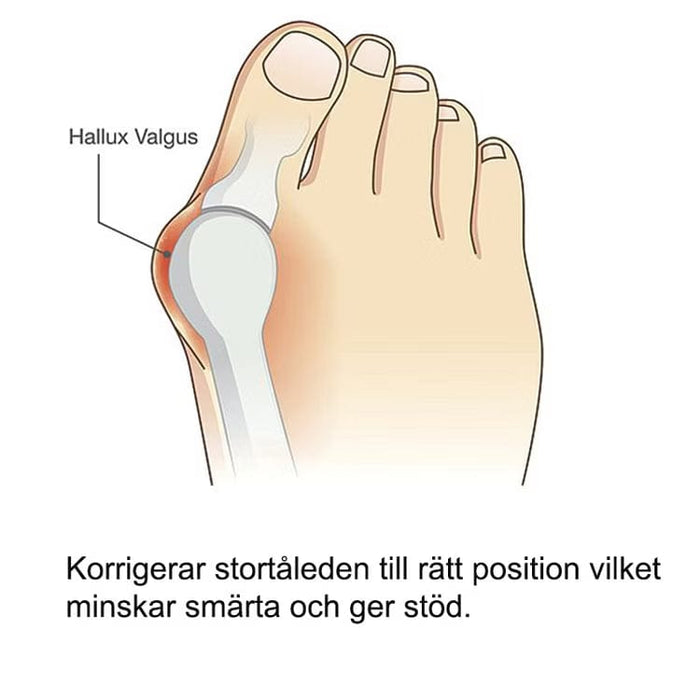 Kroppsbutiken Hallux Valgus Oletusotsikko Hallux valgus -silicone suoja
