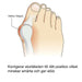 Kroppsbutiken Hallux Valgus Oletusotsikko Hallux valgus -silicone suoja