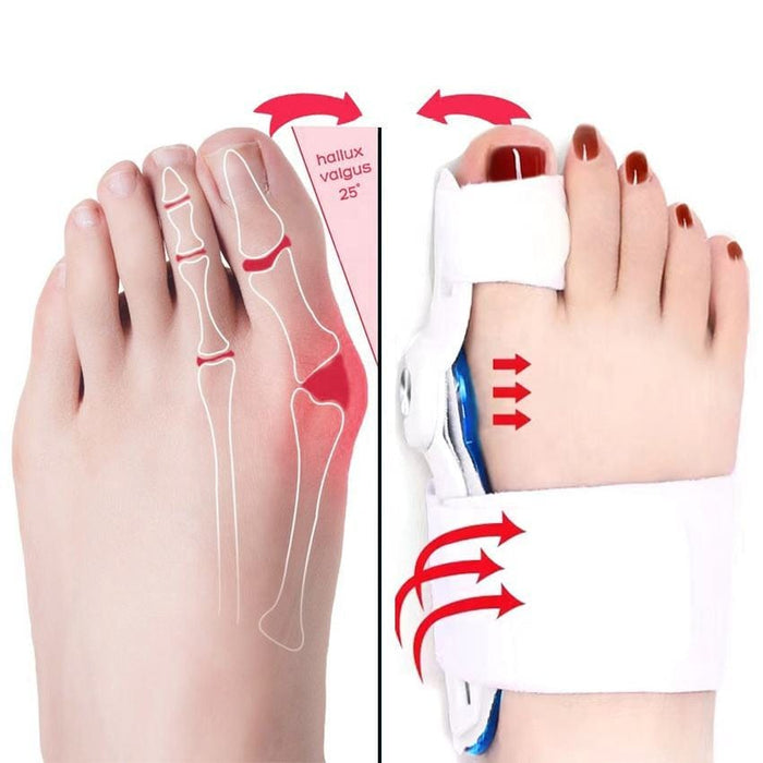 Kroppsbutiken Hallux valgus Oletusotsikko Hallux valgus yösite (korjaaja)