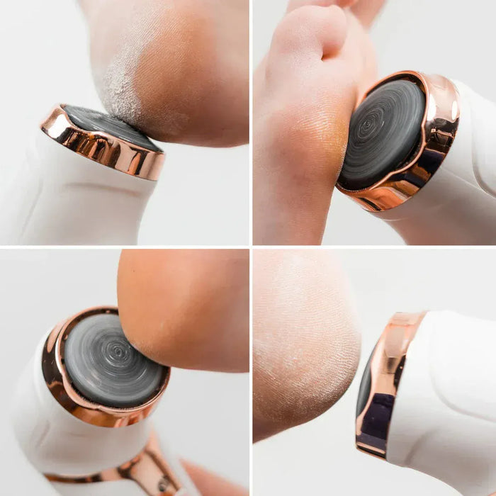 Kroppsbutiken Jalkaviila Oletusotsikko Sähkösuonikynsi- ja jalkapohjaharja imurilla