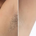 Kroppsbutiken Karvanpoistin Oletusotsikko IPL Pro Laser Karvanpoistaja