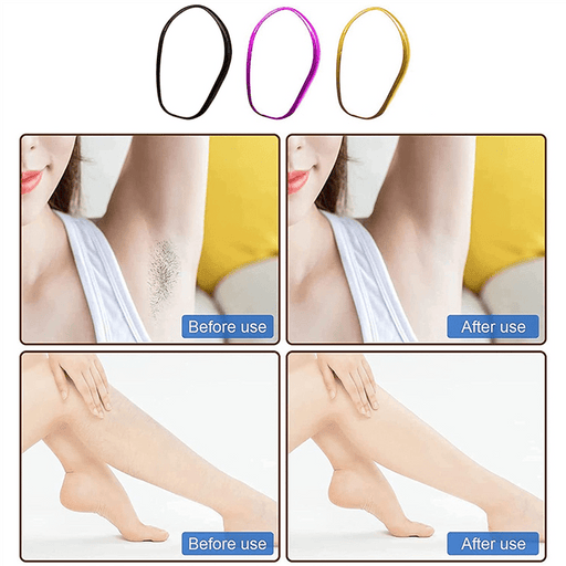 Kroppsbutiken Karvanpoisto Oletusotsikko Karvanpoistaja (kristalli)