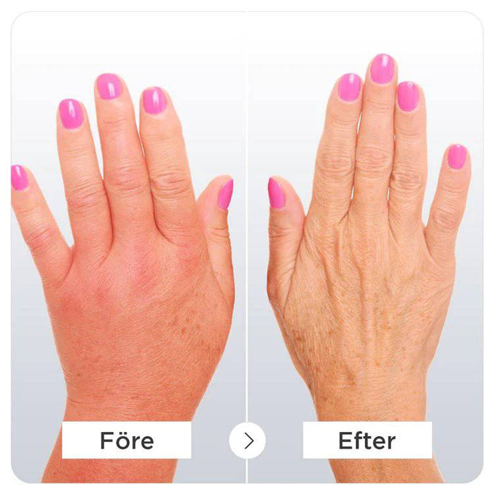 Kroppsbutiken Puristushanskat Puristuslaput nivelreumalle