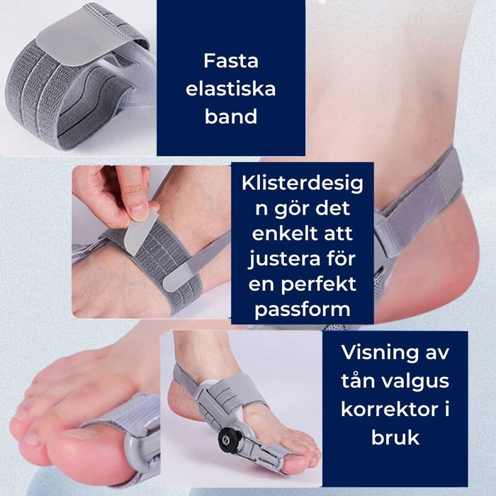 Kroppsbutiken Varpaanrupiainen Valkoinen Hallux valgus -korjaaja (säädettävä)